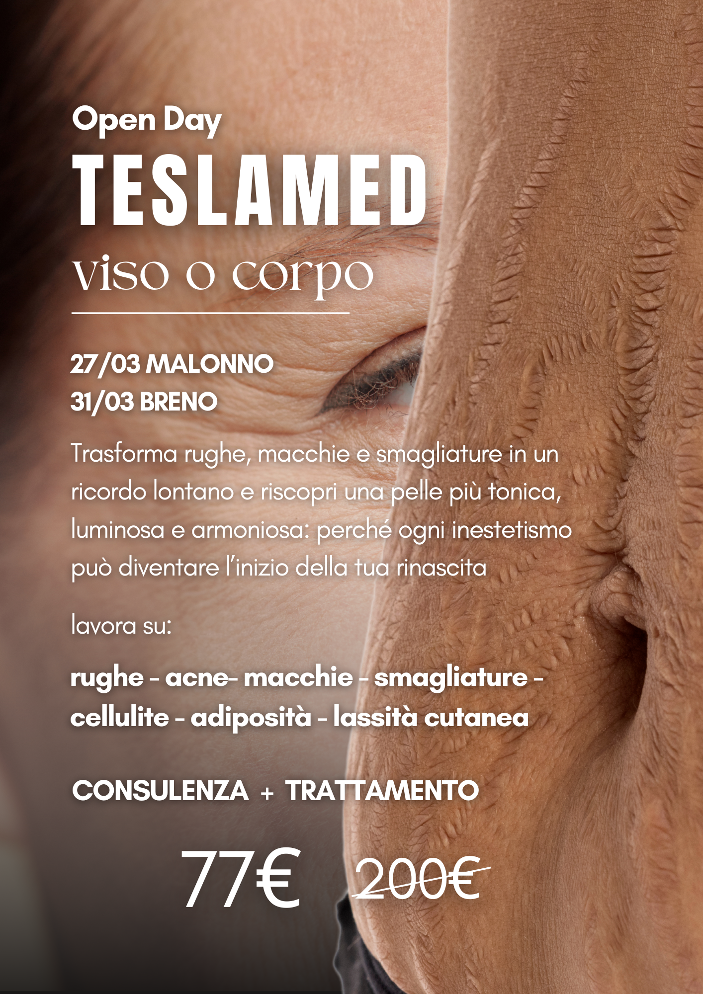 Open day Teslamed